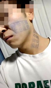 ​小伙脸盖猪肉印章多日擦不掉，专业人士解读为何难洗